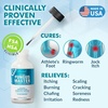 image:imageEbanel Athletes Foot Fungus Treatment Miconazole Antifungal Cream 2OzDoes not apply