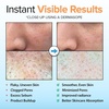 image:imageEbanel Brightening Peeling Gel with Cellulose Rice Papaya HA Cica402 Fl Oz Pack of 2