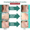 image:imageEbanel Bundle of 30 AHA 2 BHA Chemical Peel and Advanced Silicone Scar Gel