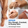 image:imageEbanel Bundle of 40 Urea Cream and Callus Remover Gel