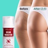image:imageEbanel Bundle of Advanced Silicone Scar Gel 1 Oz and Hyaluronic Acid Serum