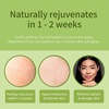 image:imageEbanel Bundle of Hyaluronic Acid Serum and 30 AHA 2 BHA Chemical Peel Exfoliant Gel