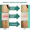 image:imageEbanel Bundle of Tattoo Aftercare Healing Balm and Advanced Silicone Scar Gel
