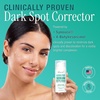 image:imageEbanel Dark Spot Remover for Hyperpigmentation Melasma and Age Spots11 Fl Oz Pack of 1