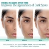 image:imageEbanel Dark Spot Remover for Hyperpigmentation Melasma and Age Spots11 Fl Oz Pack of 1