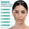 image:imageEbanel Dark Spot Remover for Hyperpigmentation Melasma and Age Spots155 Ounce Pack of 1