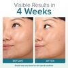 image:imageEbanel Retinol Cream for Face 35Oz with Collagen Peptide amp Hyaluronic Acid