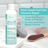 image:imageEbanel Set of Salon Grade Callus Remover for Feet Gel  40 Urea Foot Cream655 Ounce Pack of 2