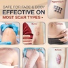 image:imageEbanel Silicone Scar Gel with Allantoin Emu Oil Vitamin E Onion Extract