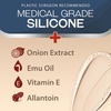image:imageEbanel Silicone Scar Gel with Allantoin Emu Oil Vitamin E Onion Extract