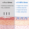 image:imageEbanel Urea Cream 40 plus Salicylic Acid 2 for Dry Cracked Feet Skin 2PK46 Ounce Pack of 2