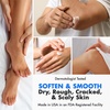 image:imageEbanel Urea Cream 40 plus Salicylic Acid 2 for Dry Cracked Feet Skin 2PK46 Ounce Pack of 2